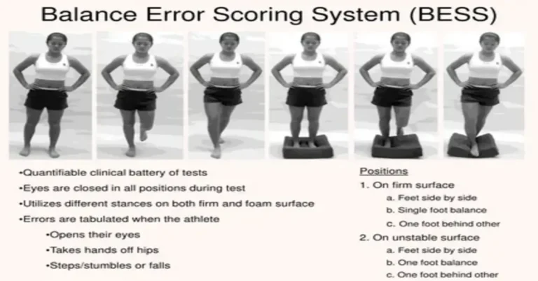 Mastering the DOTS Scoring System